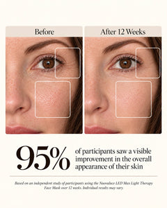 Nuovaluce LED Max independent study before and after visual