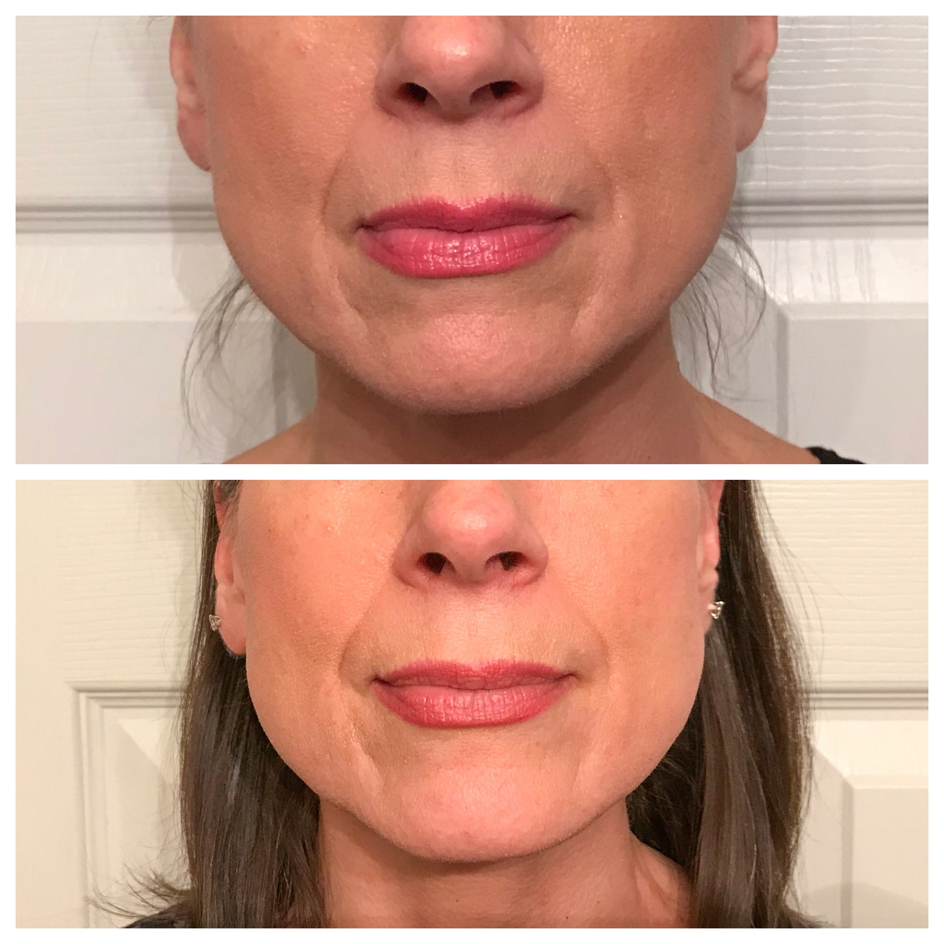 Nuovaluce customer before and after result 81