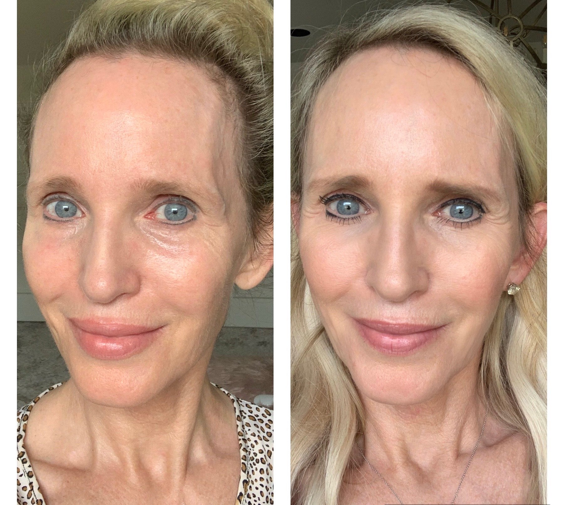 Nuovaluce customer before and after result 89