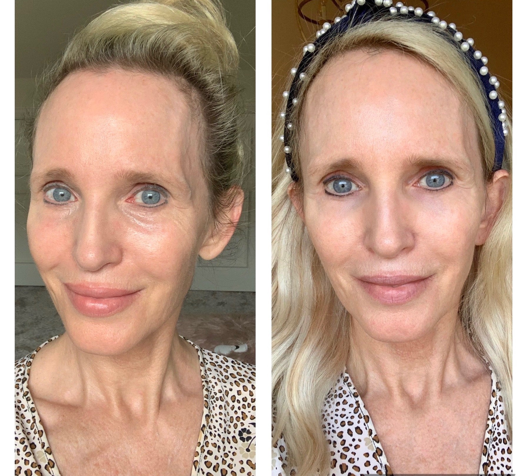 Nuovaluce customer before and after result 90