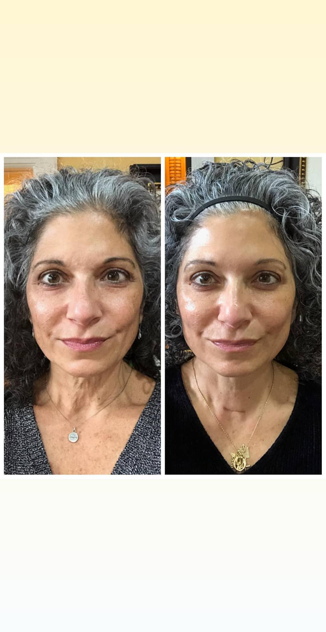 Nuovaluce customer before and after result 97