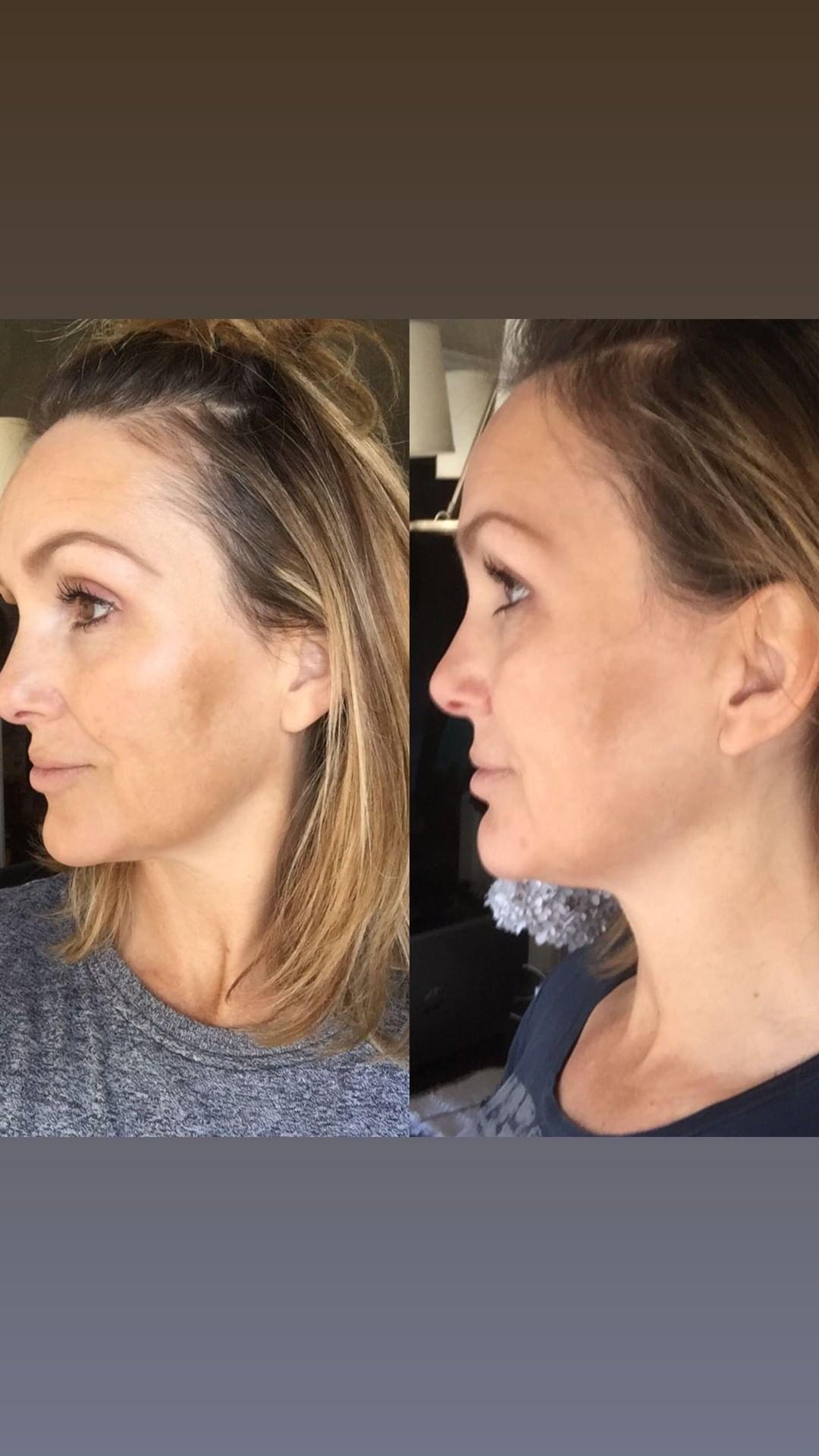 Nuovaluce customer before and after result 102