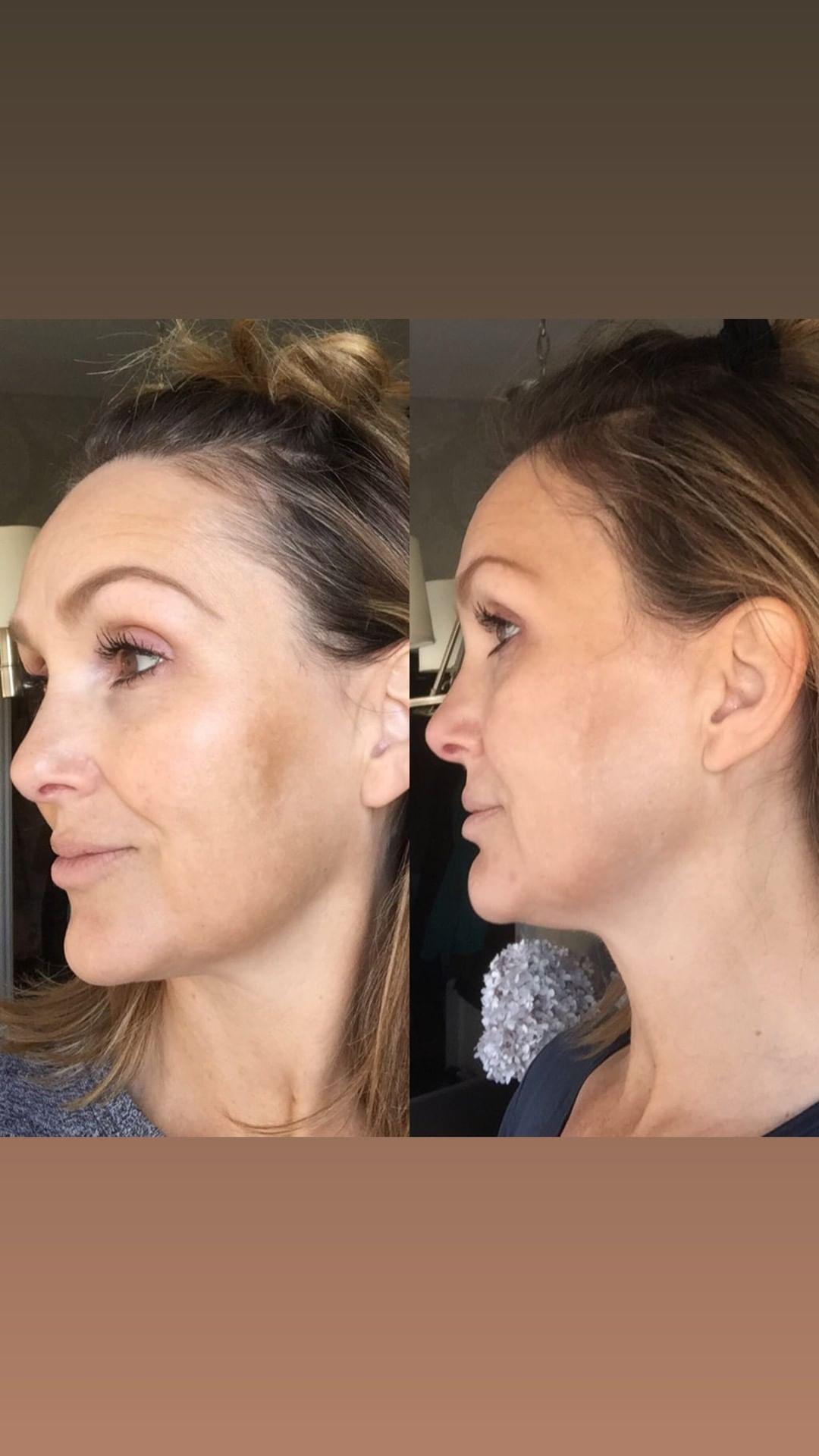 Nuovaluce customer before and after result 103
