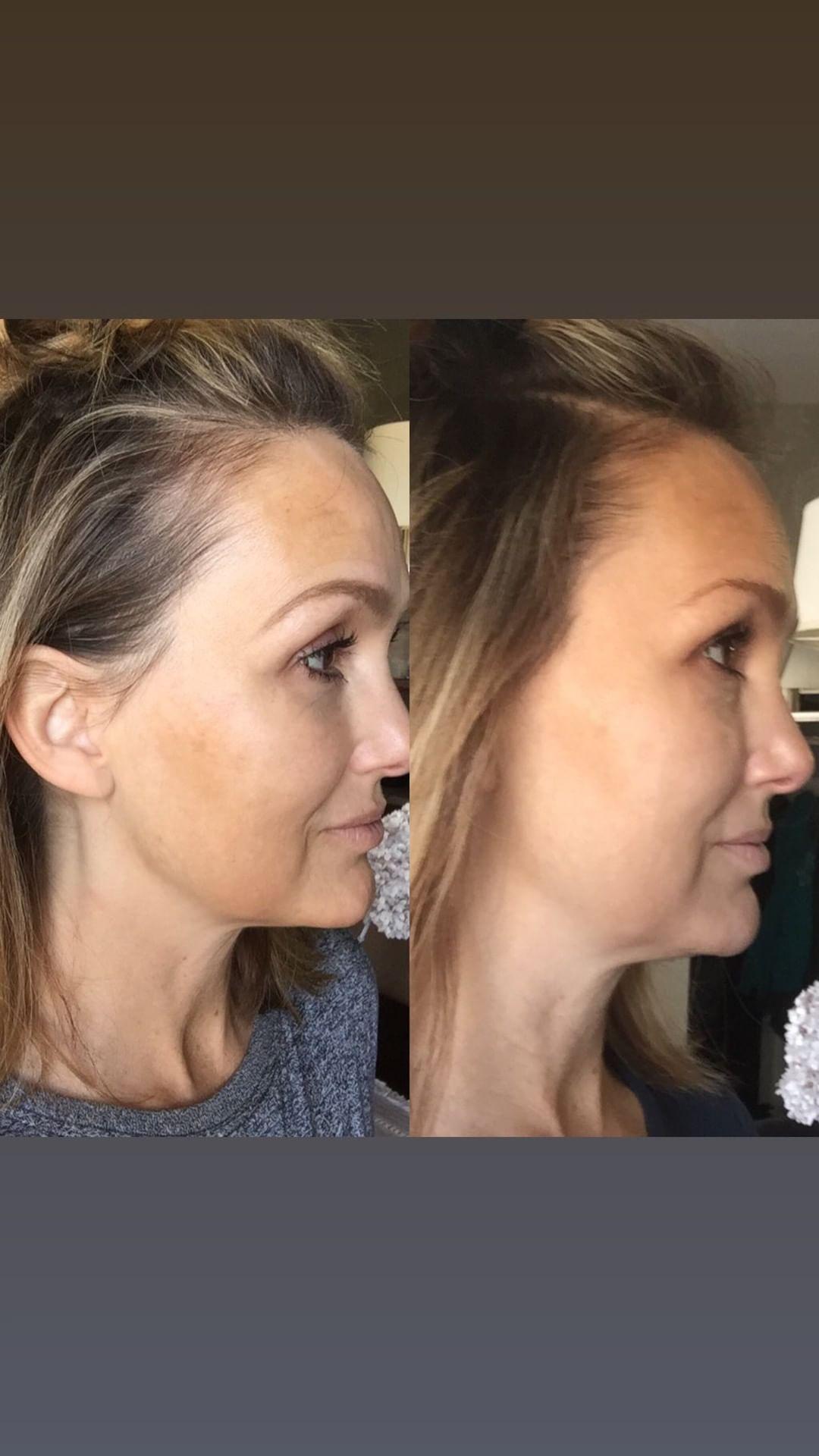 Nuovaluce customer before and after result 104