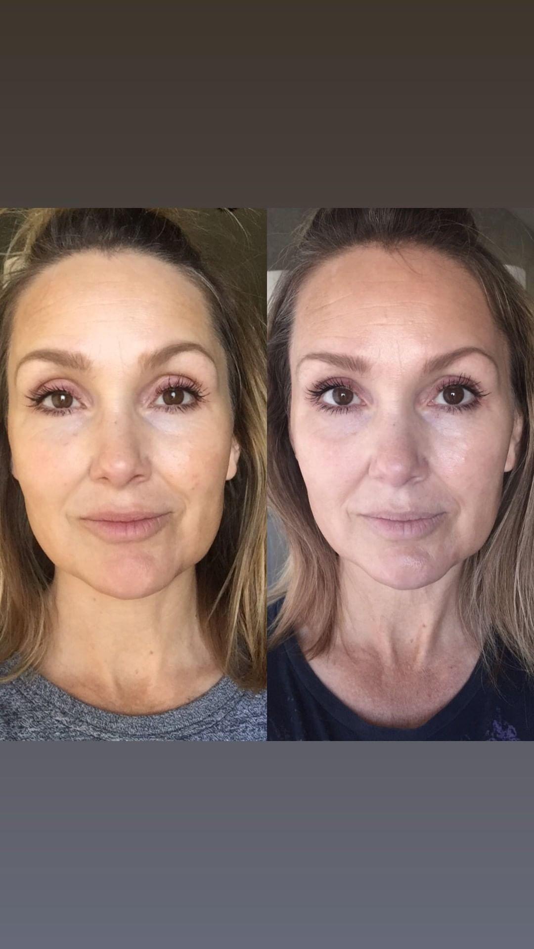 Nuovaluce customer before and after result 105