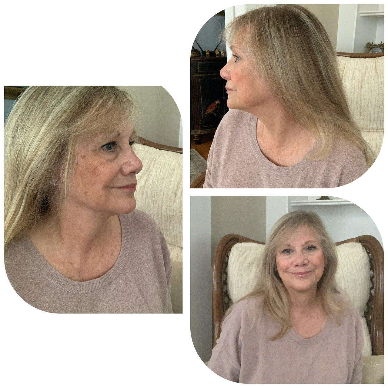 Nuovaluce customer before and after result 110