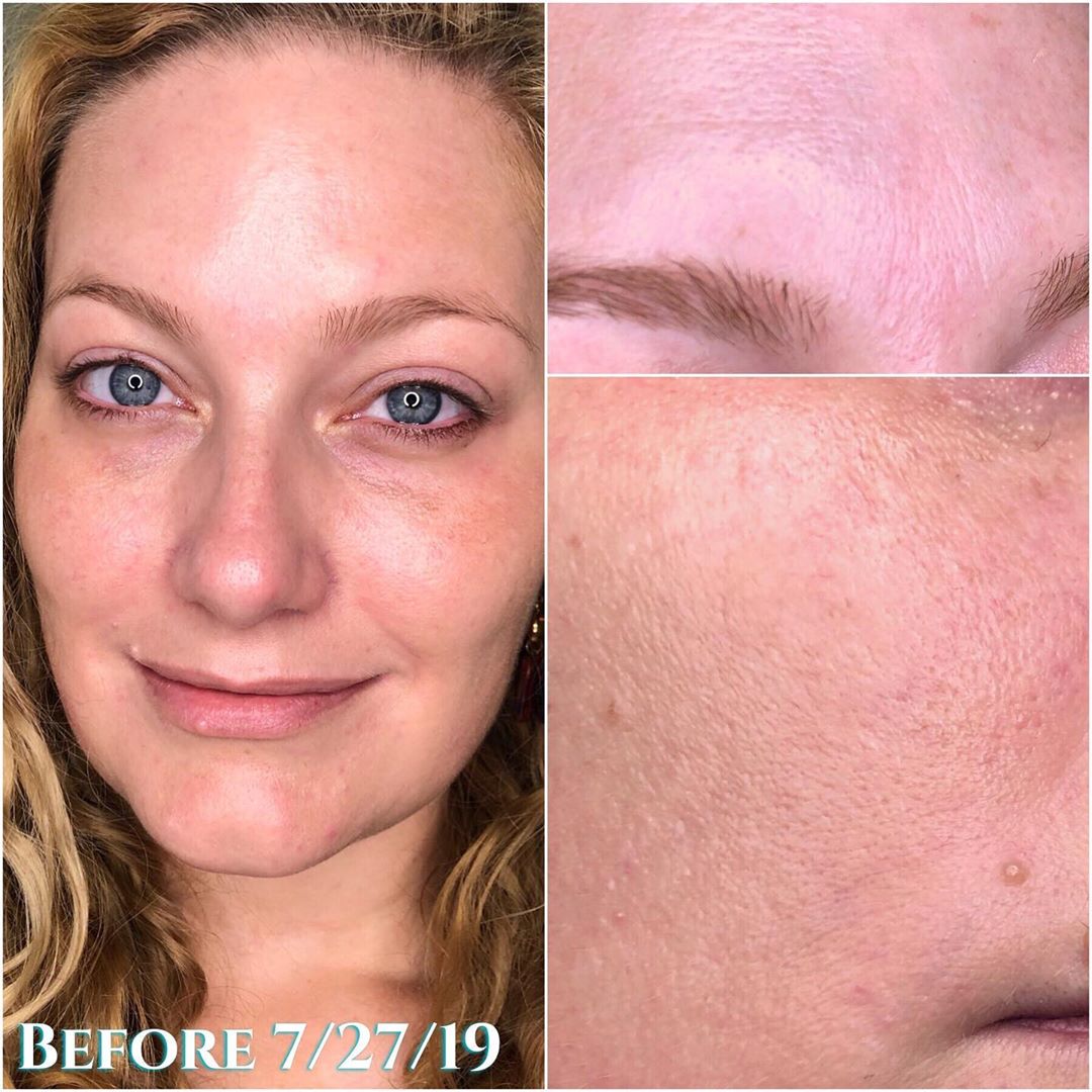 Nuovaluce customer before and after result 120