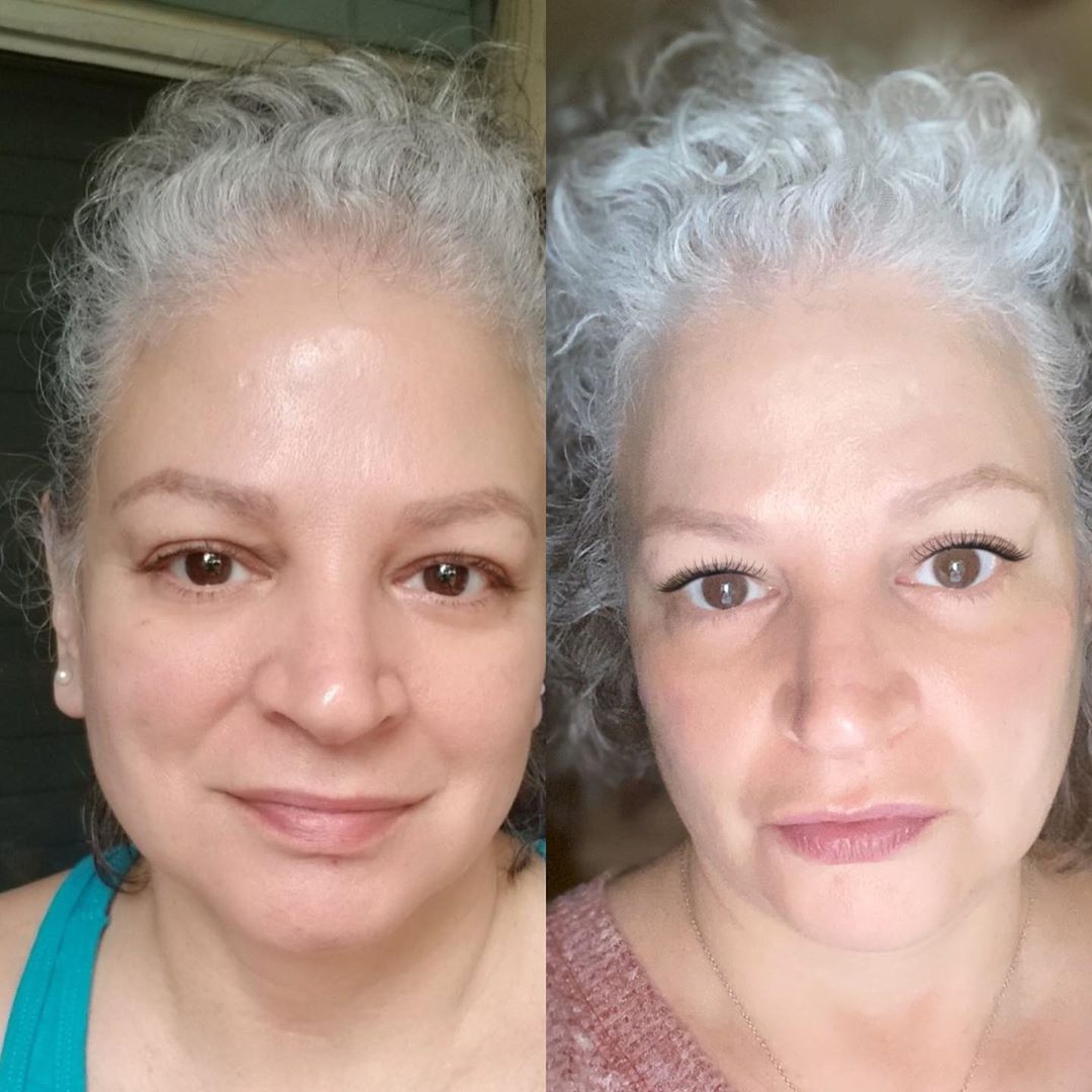 Nuovaluce customer before and after result 124
