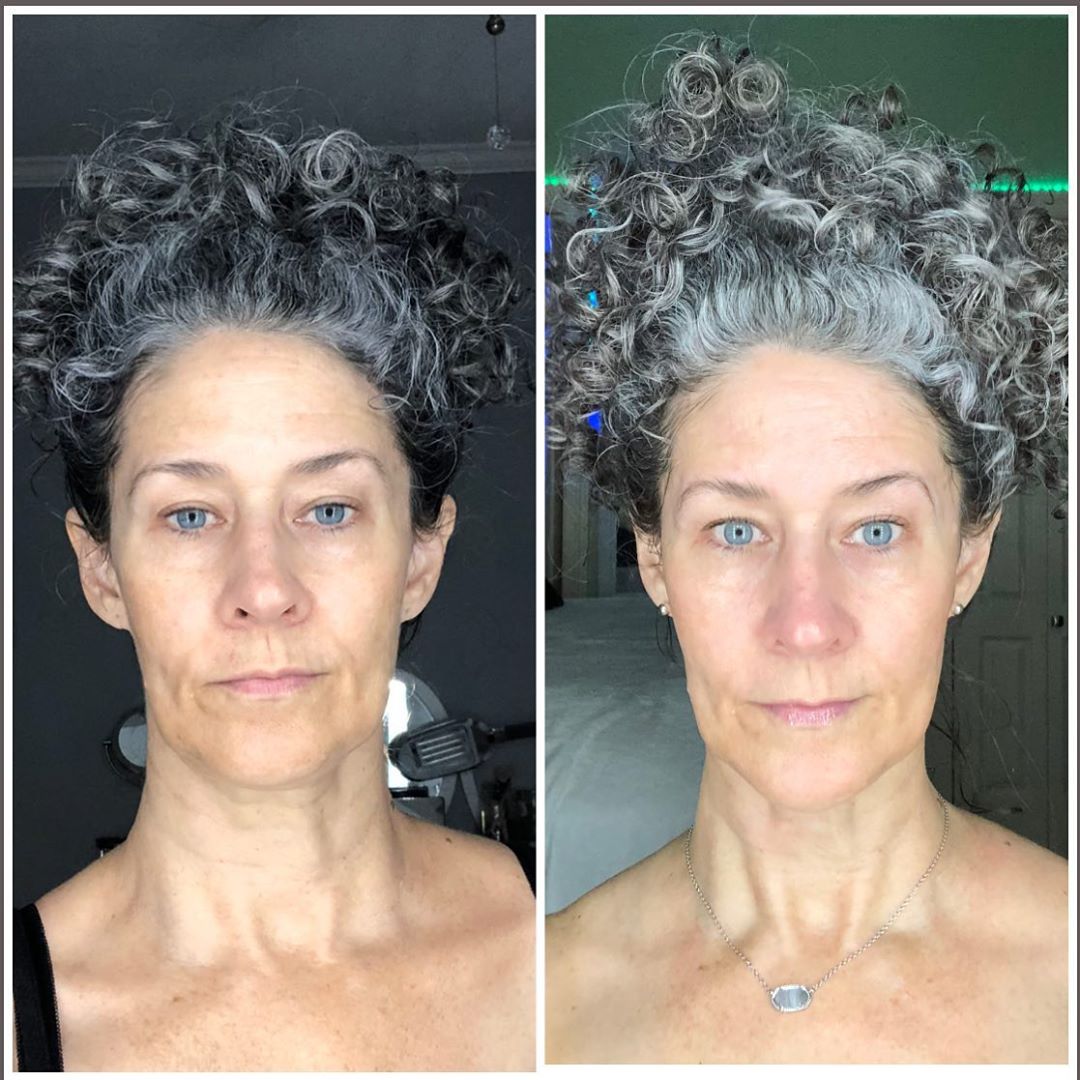 Nuovaluce customer before and after result 125