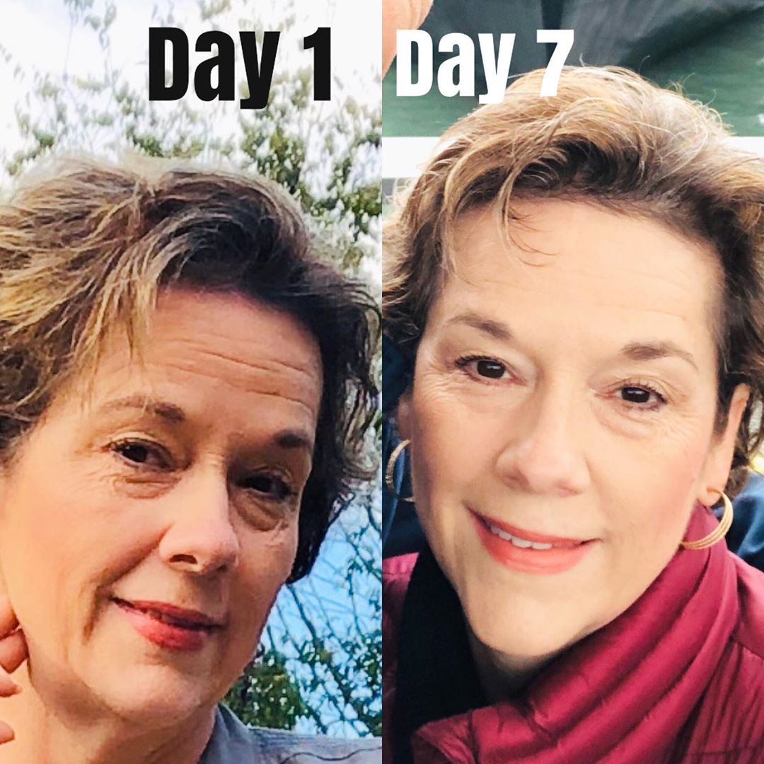 Nuovaluce customer before and after result 126