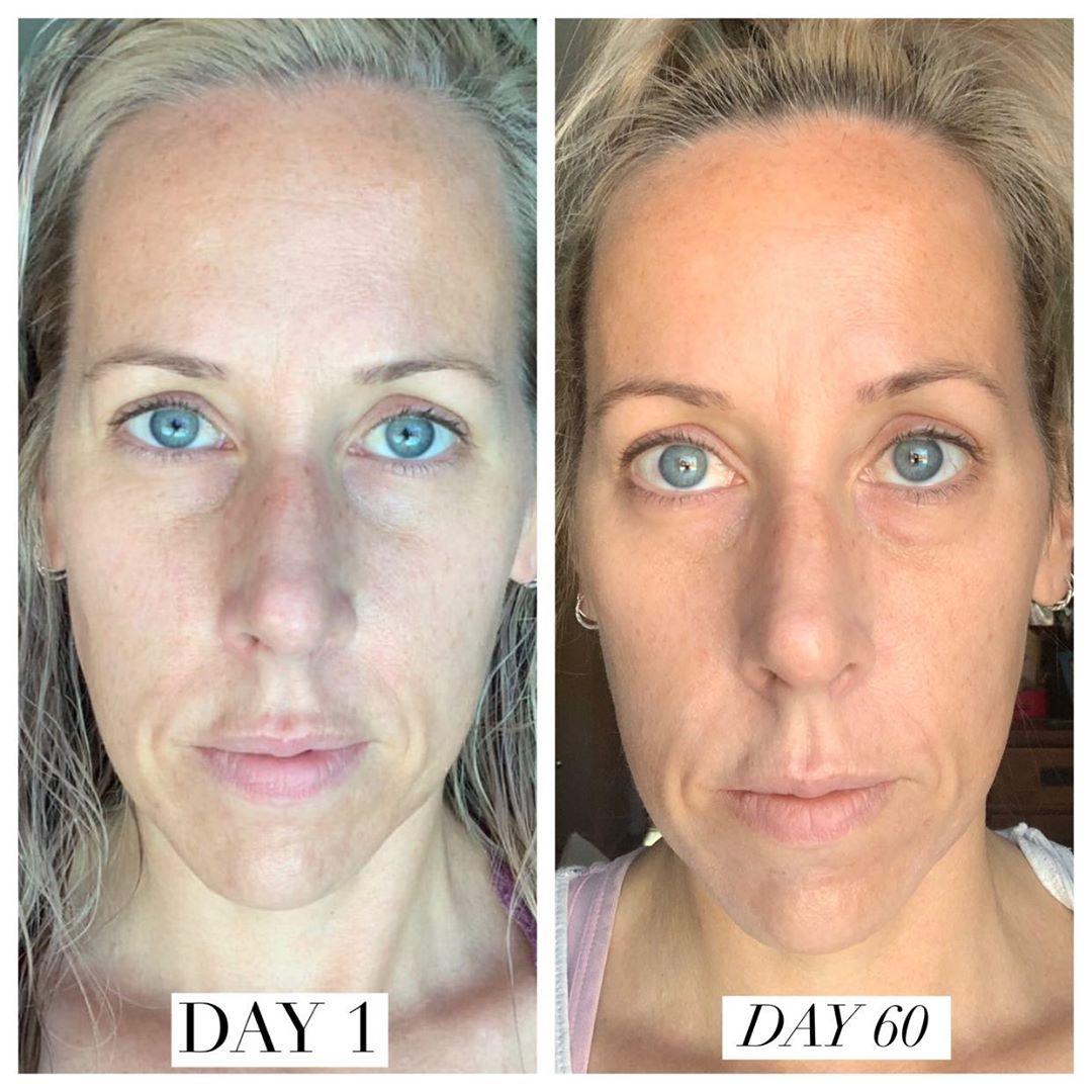 Nuovaluce customer before and after result 127
