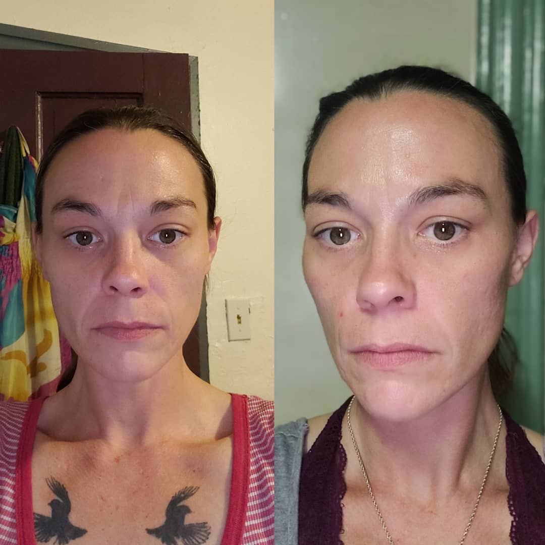 Nuovaluce customer before and after result 128