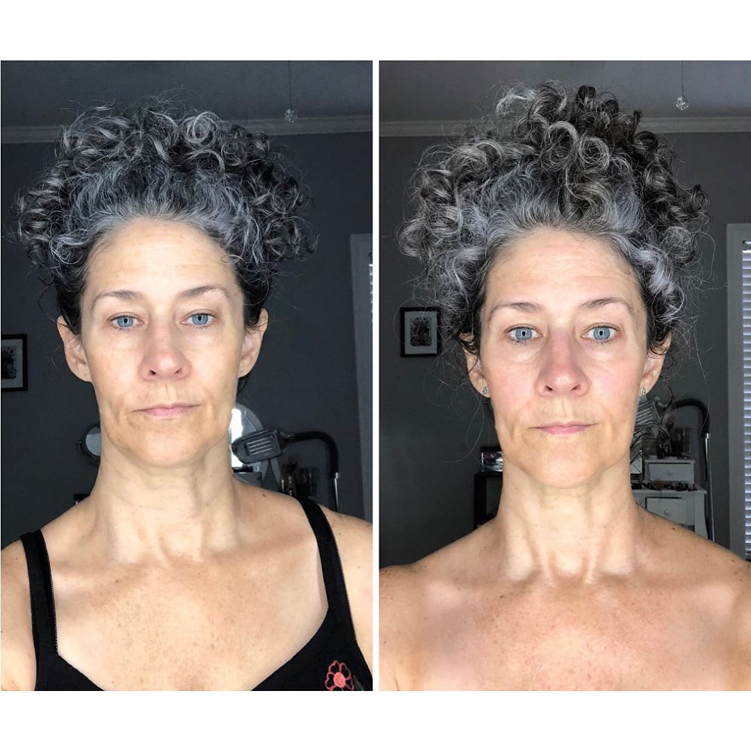 Nuovaluce customer before and after result 129