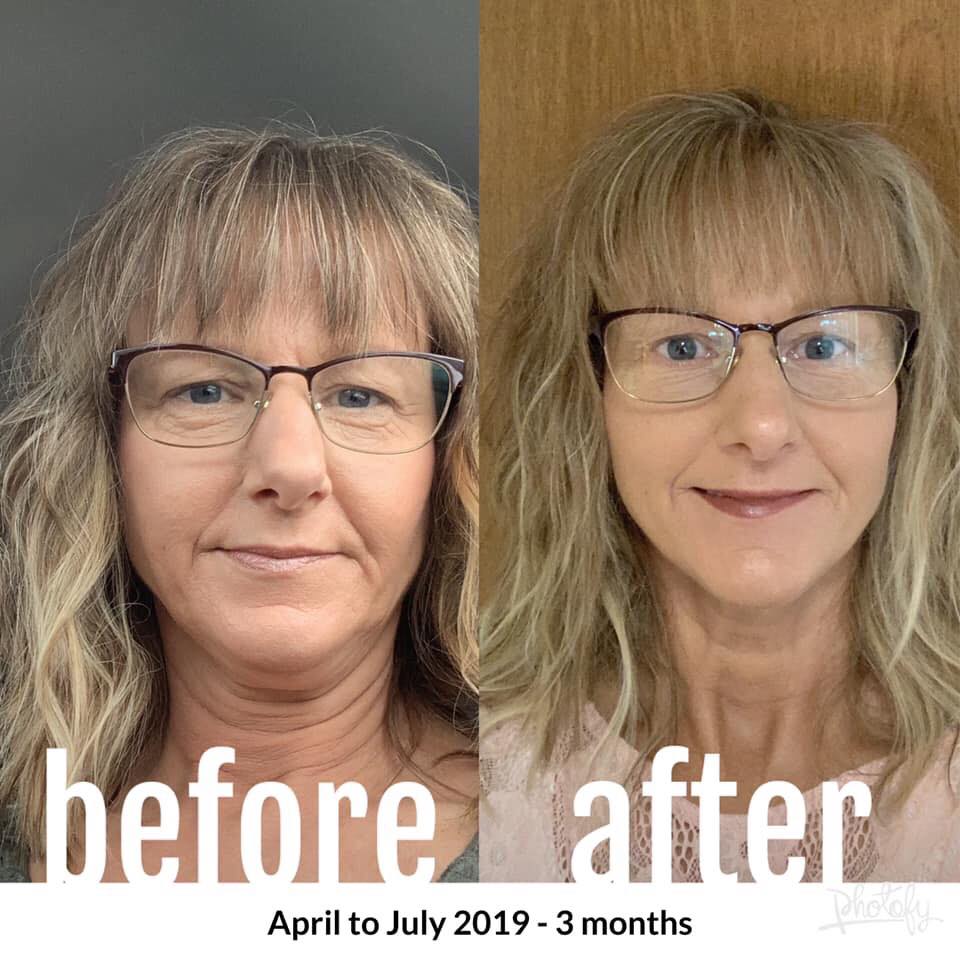 Nuovaluce customer before and after result 132