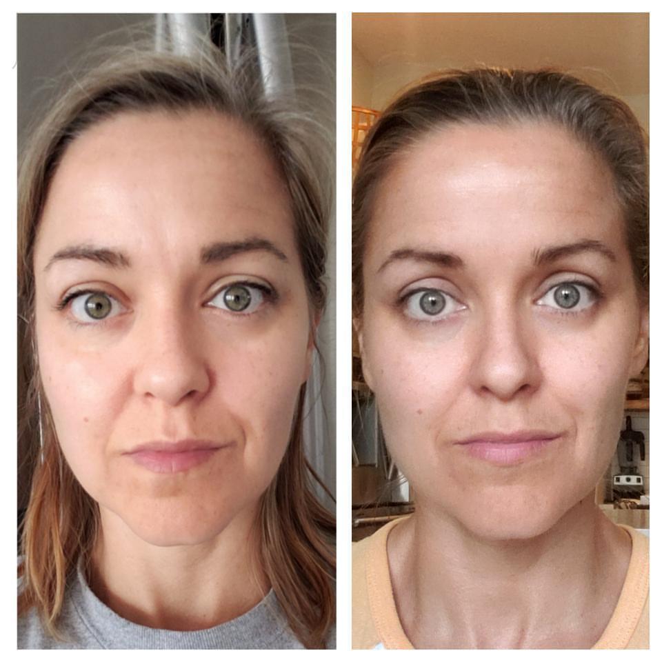 Nuovaluce customer before and after result 133