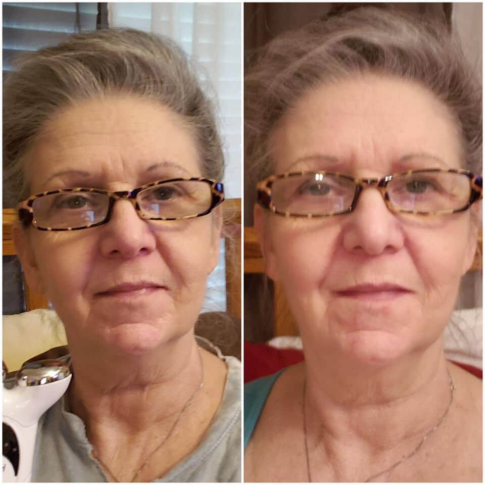 Nuovaluce customer before and after result 134