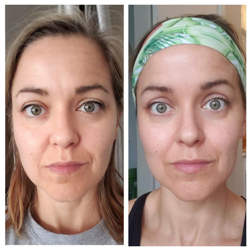 Nuovaluce customer before and after result 135