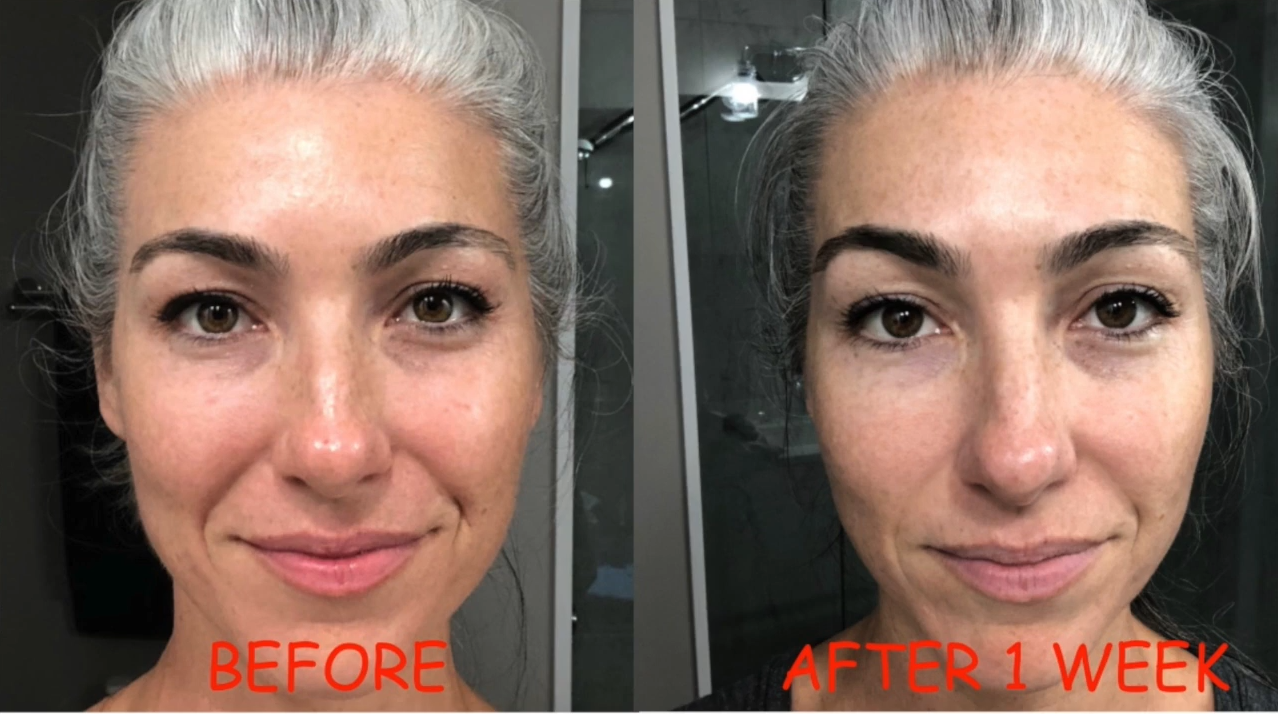Nuovaluce customer before and after result 136