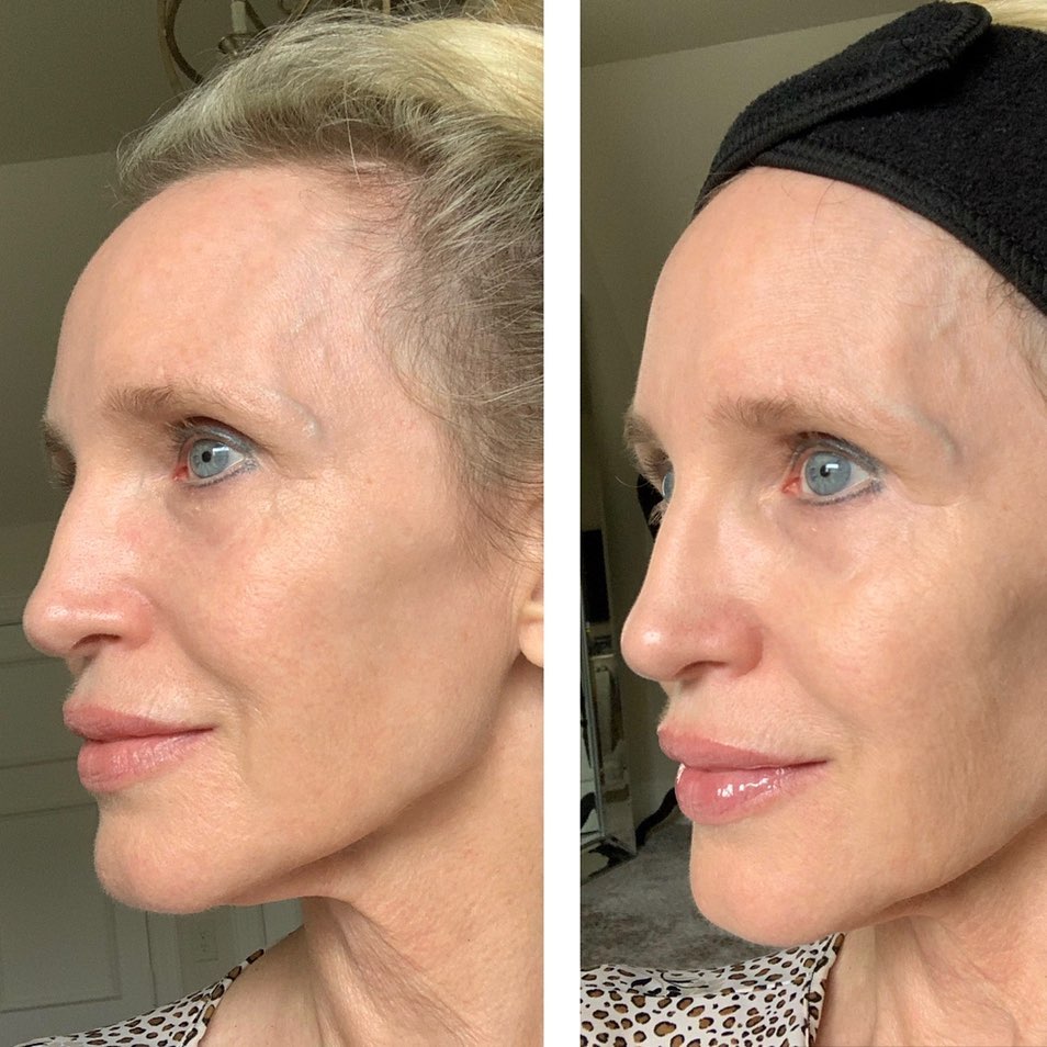 Nuovaluce customer before and after result 137