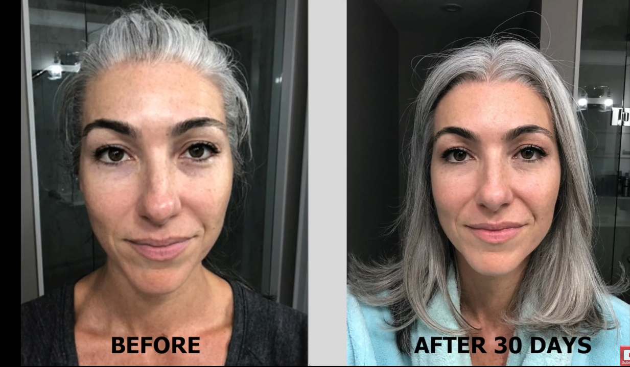 Nuovaluce customer before and after result 139