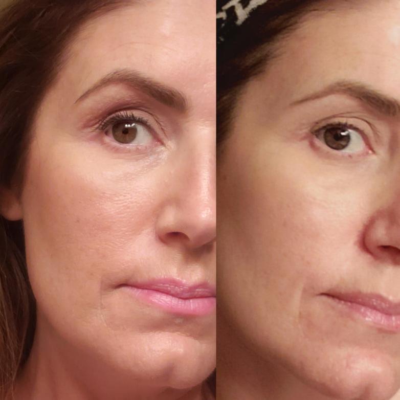 Nuovaluce customer before and after result 146