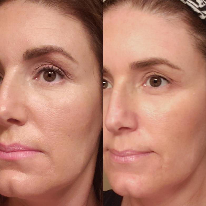 Nuovaluce customer before and after result 147