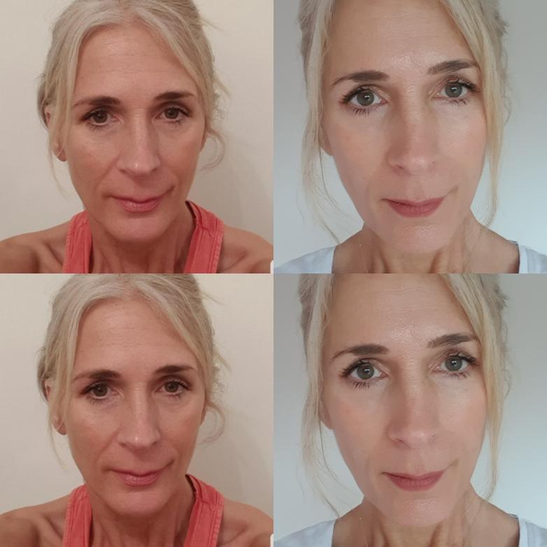 Nuovaluce customer before and after result 149