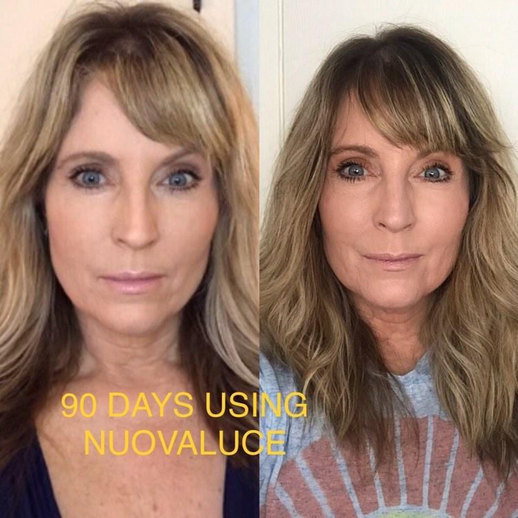 Nuovaluce customer before and after result 150