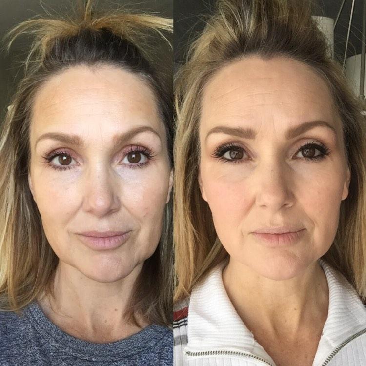 Nuovaluce customer before and after result 151