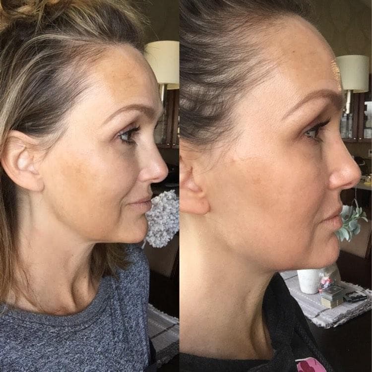 Nuovaluce customer before and after result 152