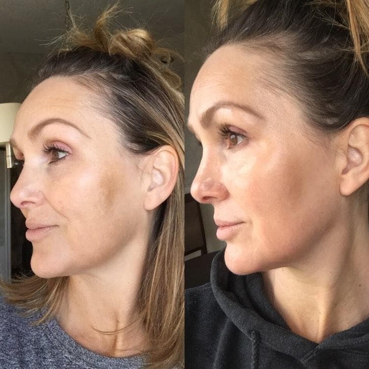 Nuovaluce customer before and after result 153