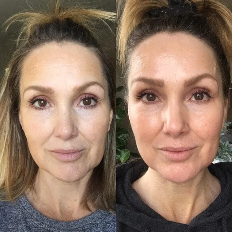 Nuovaluce customer before and after result 154