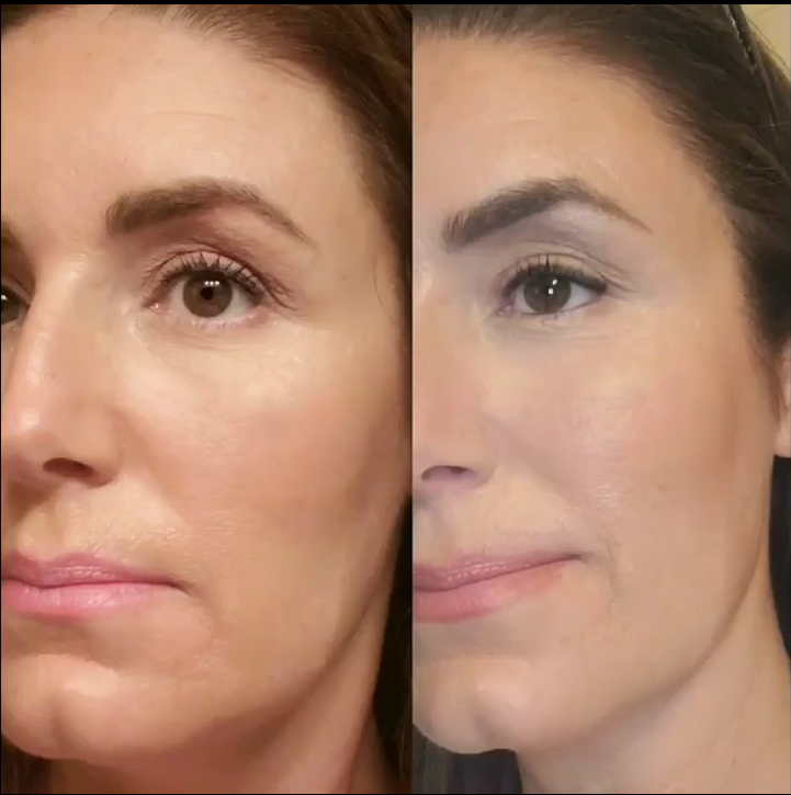 Nuovaluce customer before and after result 155