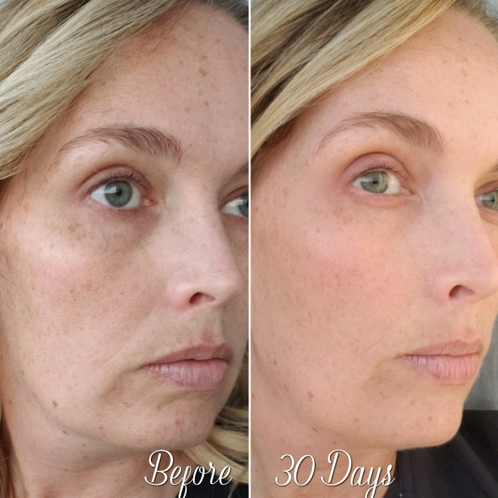 Nuovaluce customer before and after result 157