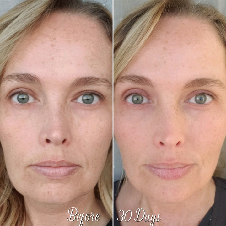 Nuovaluce customer before and after result 158