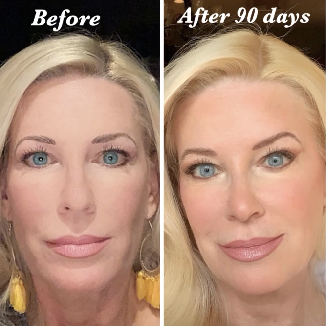 Nuovaluce customer before and after result 160