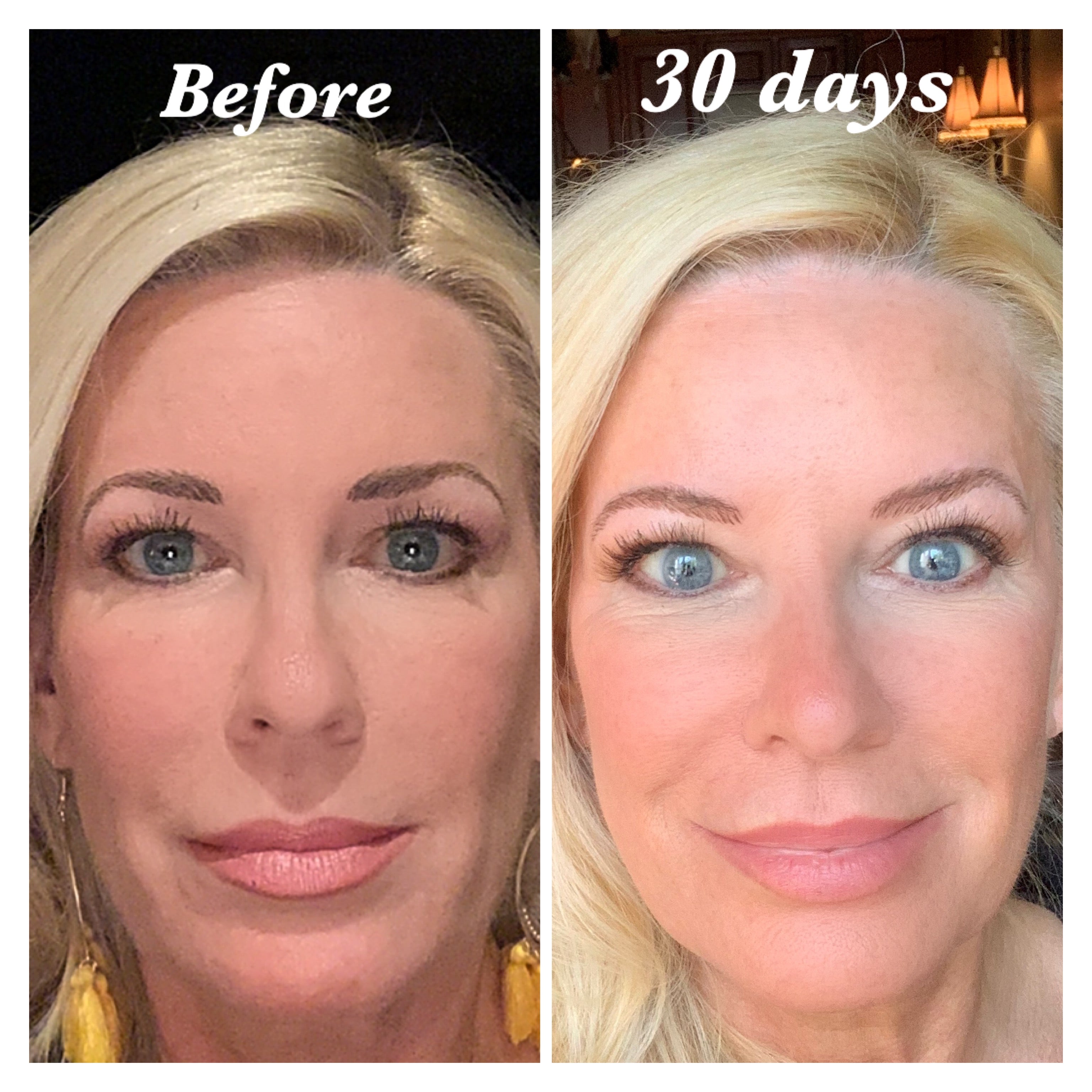 Nuovaluce customer before and after result 181