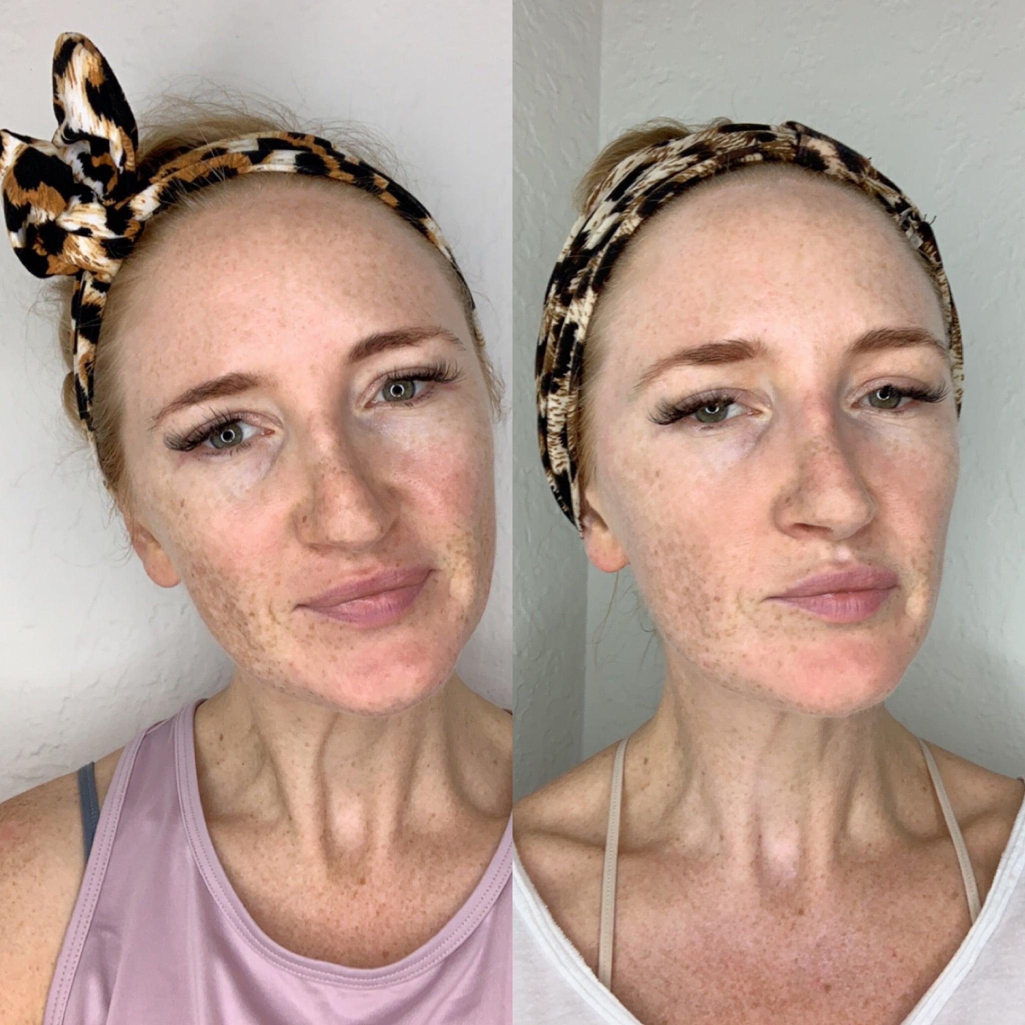 Nuovaluce customer before and after result 210
