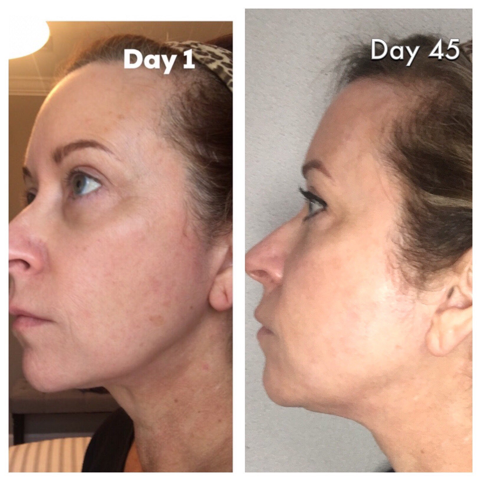 Nuovaluce customer before and after result 215