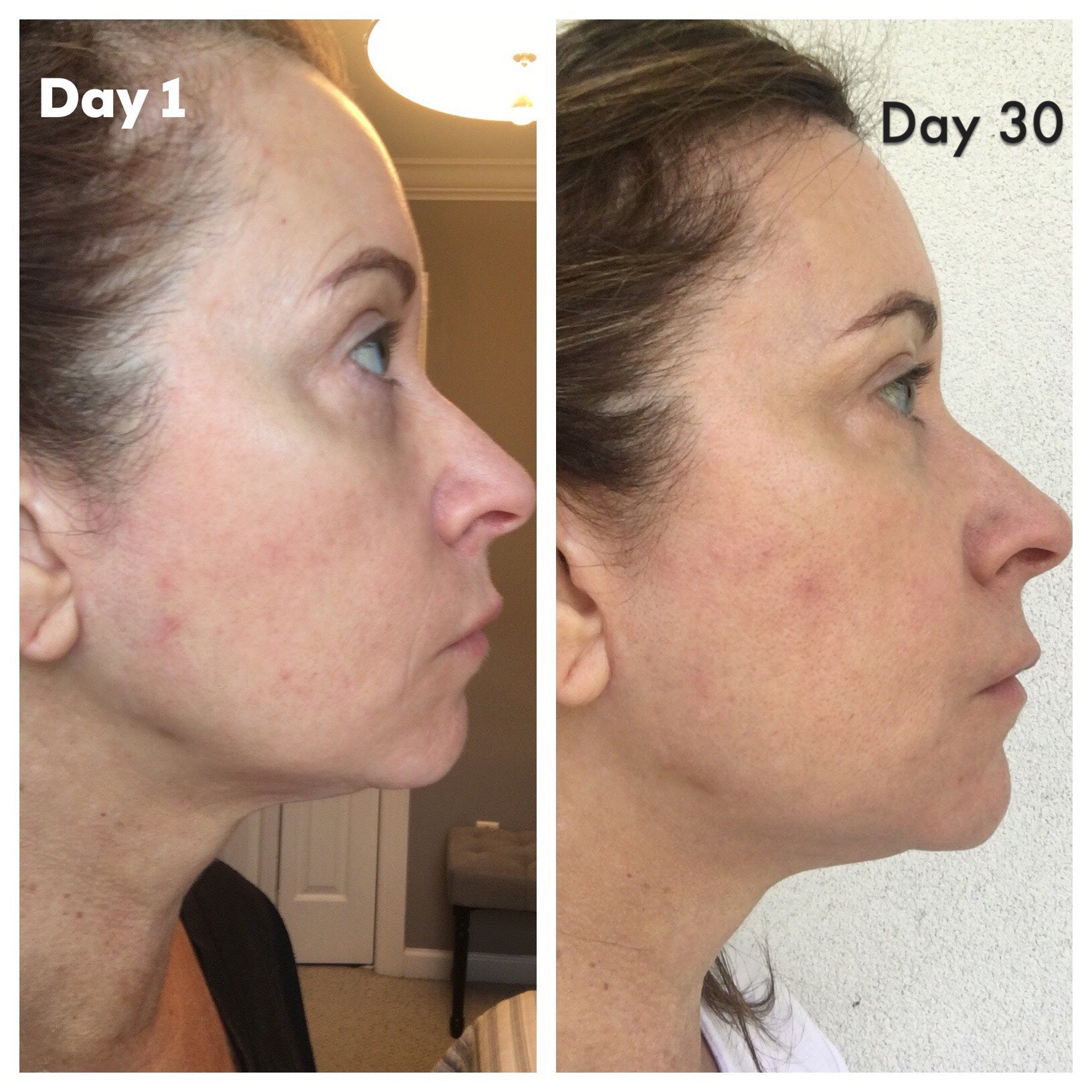 Nuovaluce customer before and after result 216