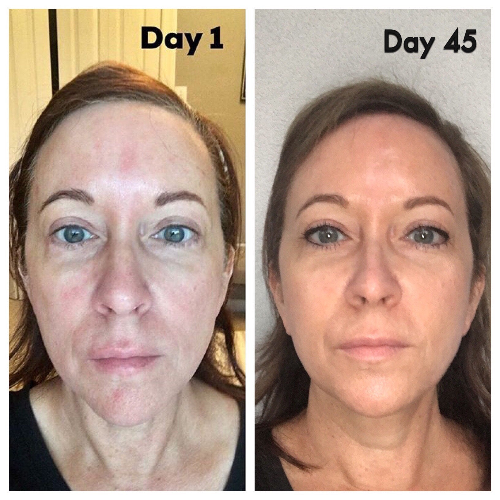 Nuovaluce customer before and after result 217