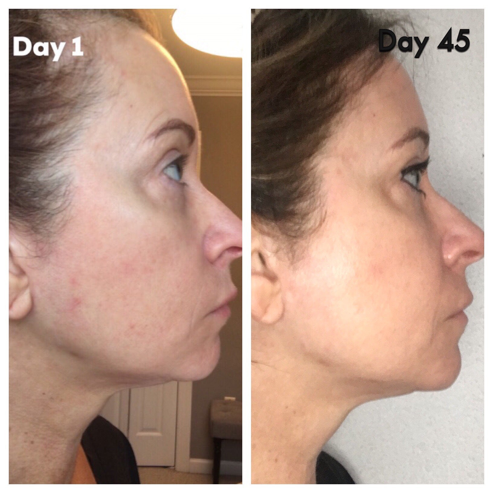 Nuovaluce customer before and after result 218