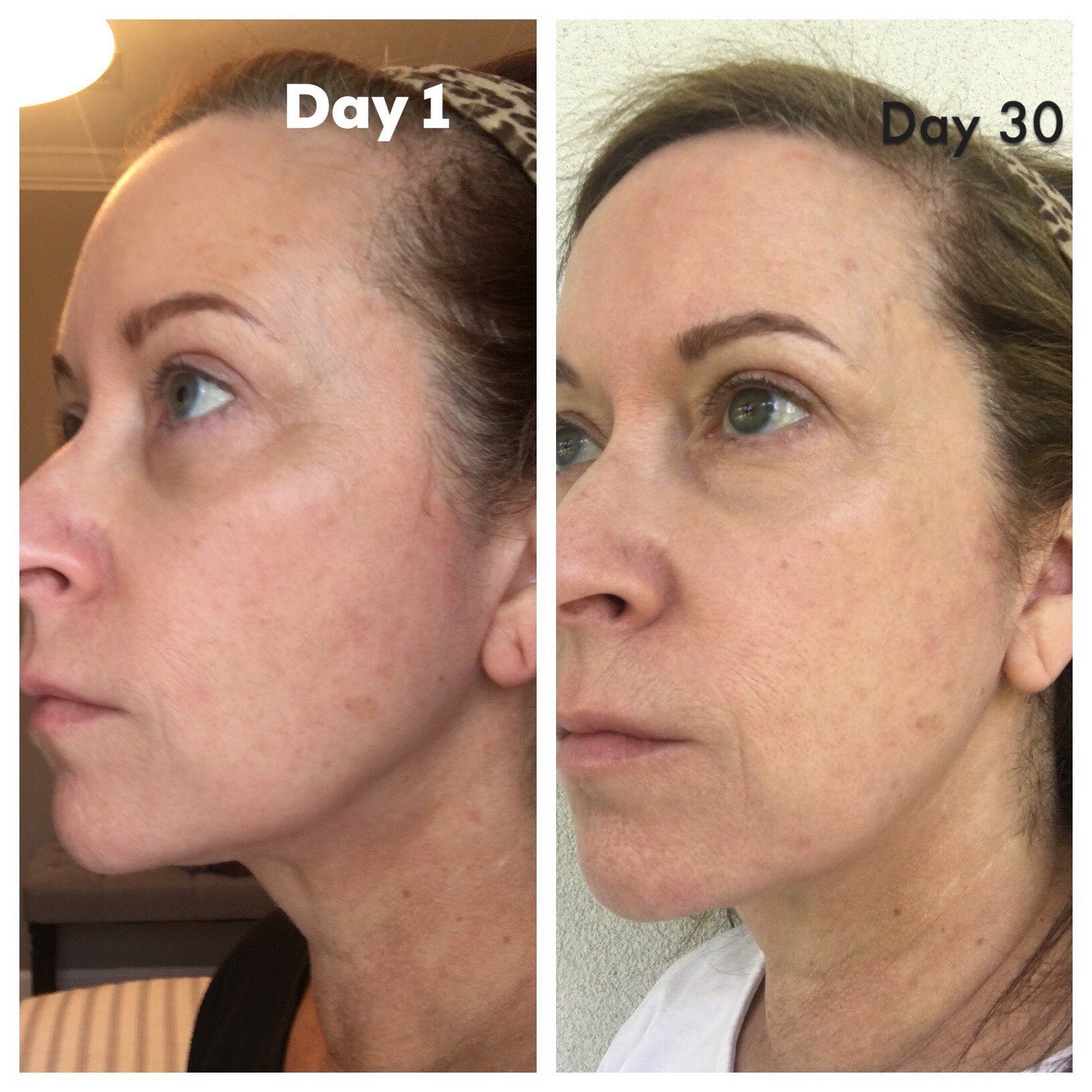 Nuovaluce customer before and after result 219