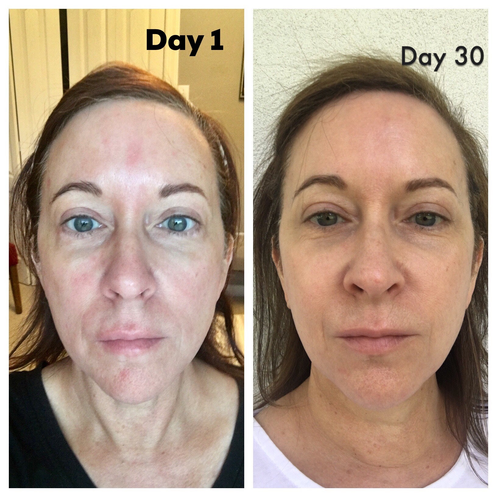 Nuovaluce customer before and after result 220
