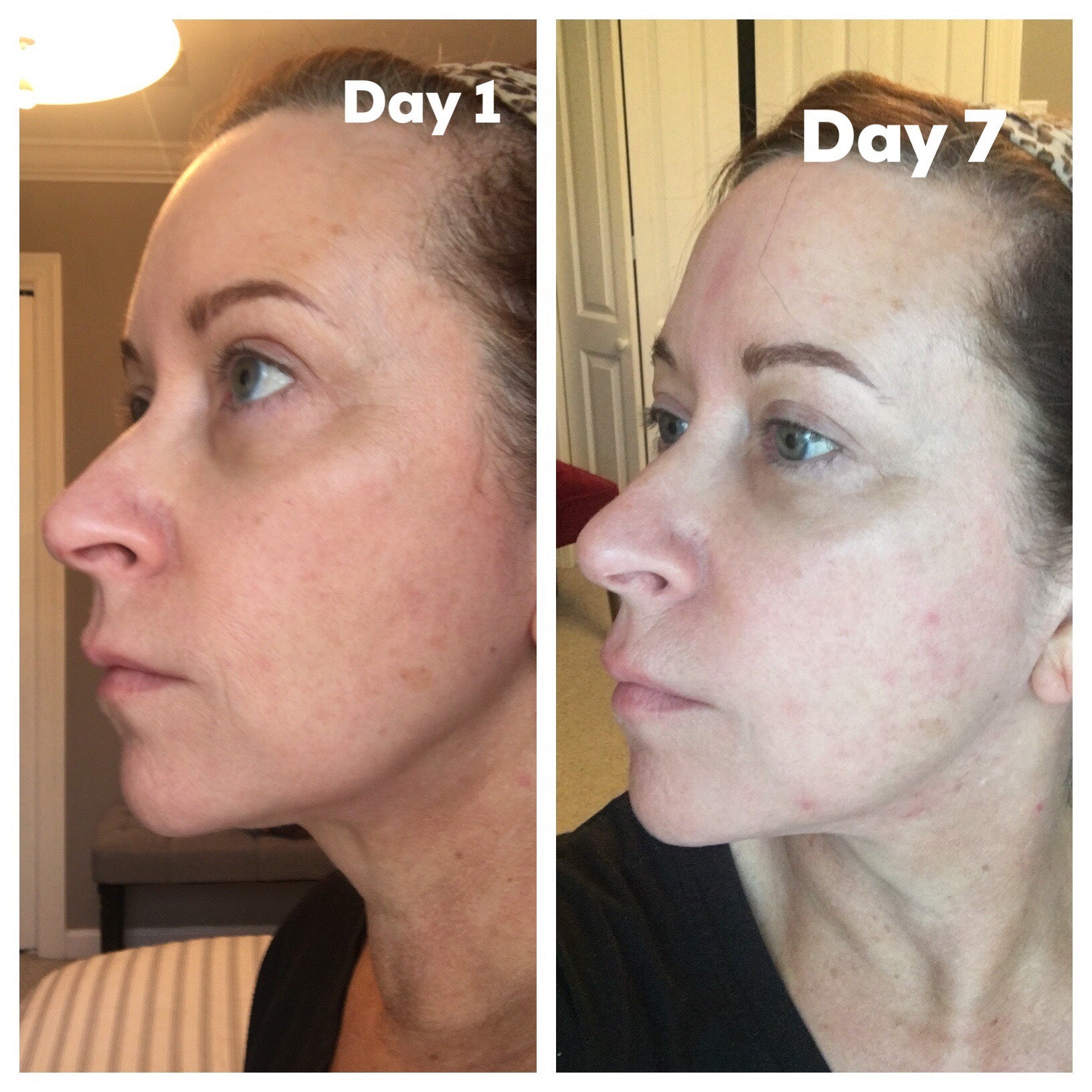 Nuovaluce customer before and after result 221