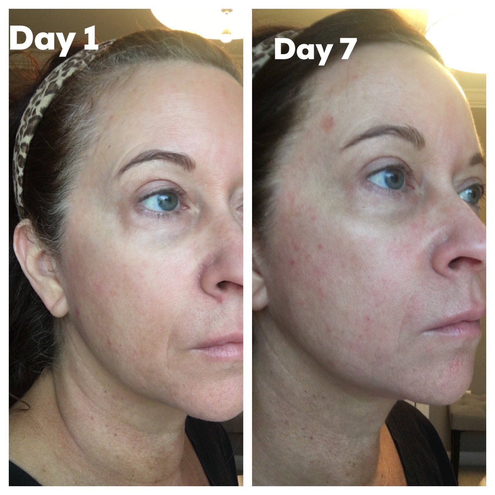 Nuovaluce customer before and after result 222