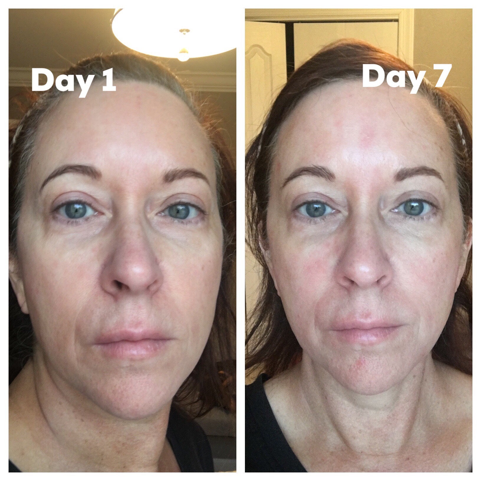 Nuovaluce customer before and after result 223