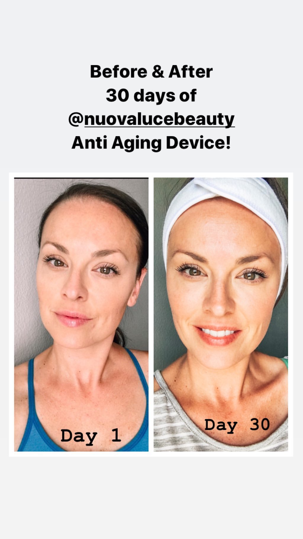 Nuovaluce customer before and after result 225