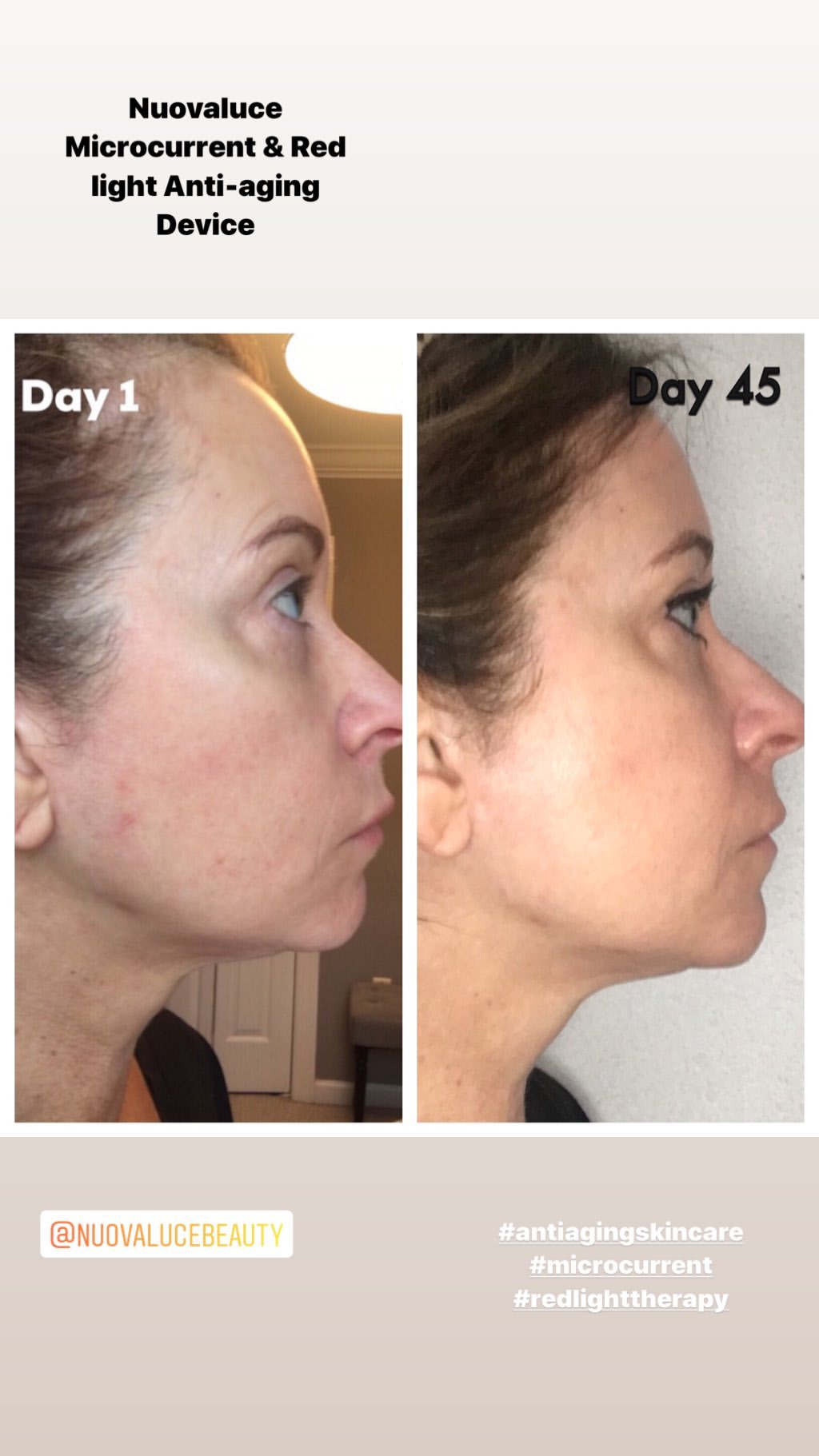 Nuovaluce customer before and after result 226