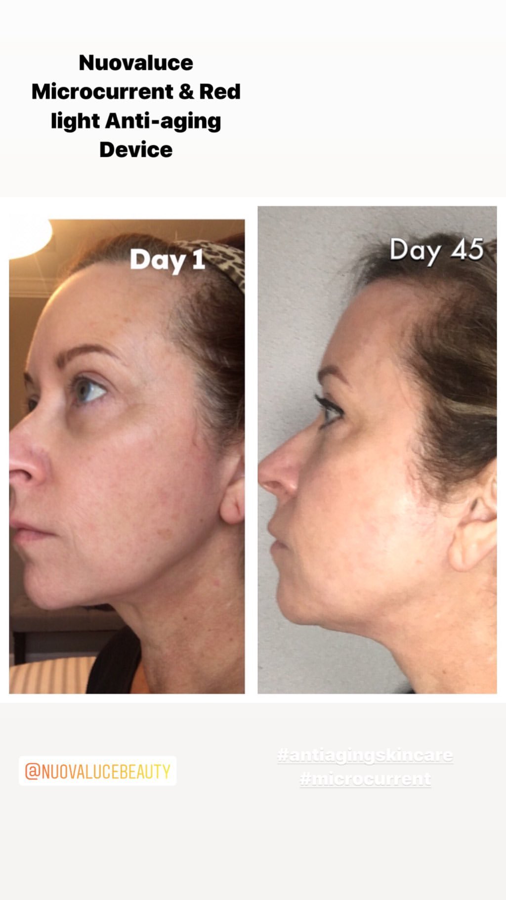 Nuovaluce customer before and after result 227